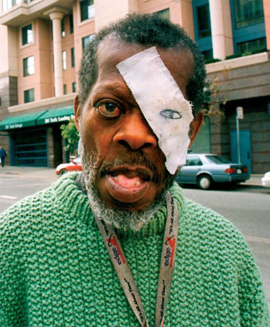 Black Man Eye Patch Photo by gerftyfarmers Photobucket