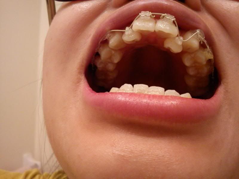 photo IMG_20130528_214712.jpg