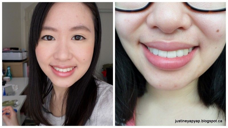  photo bracesofffirstwhitening.jpg