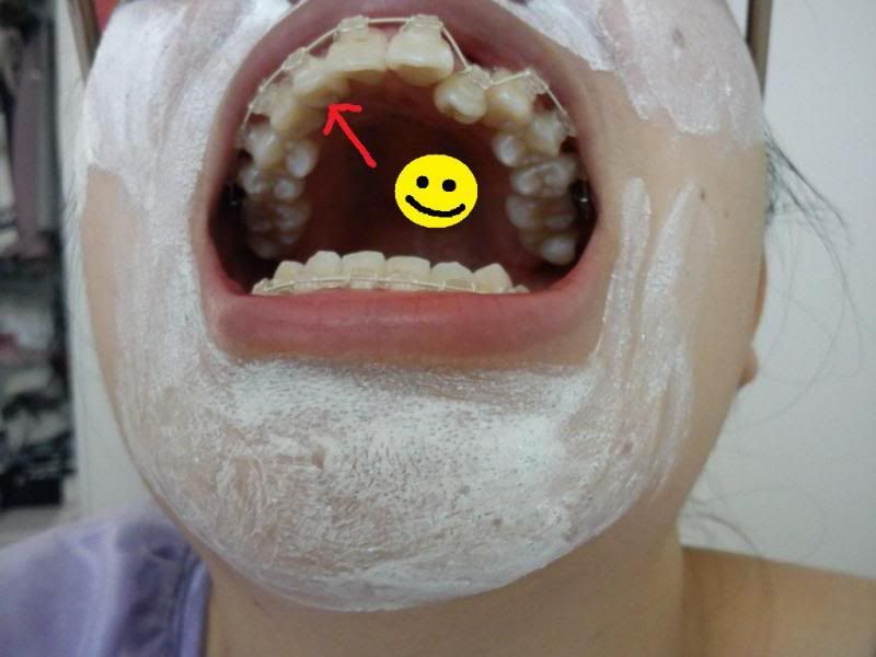photo firsttoothmoving-1.jpg