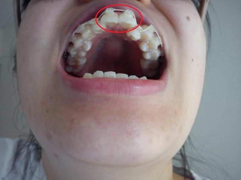 photo frontteeth-1.jpg