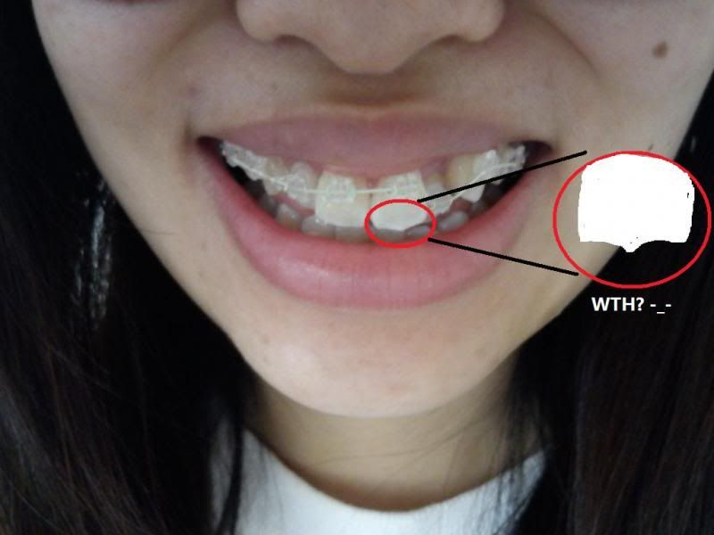 photo fronttooth.jpg