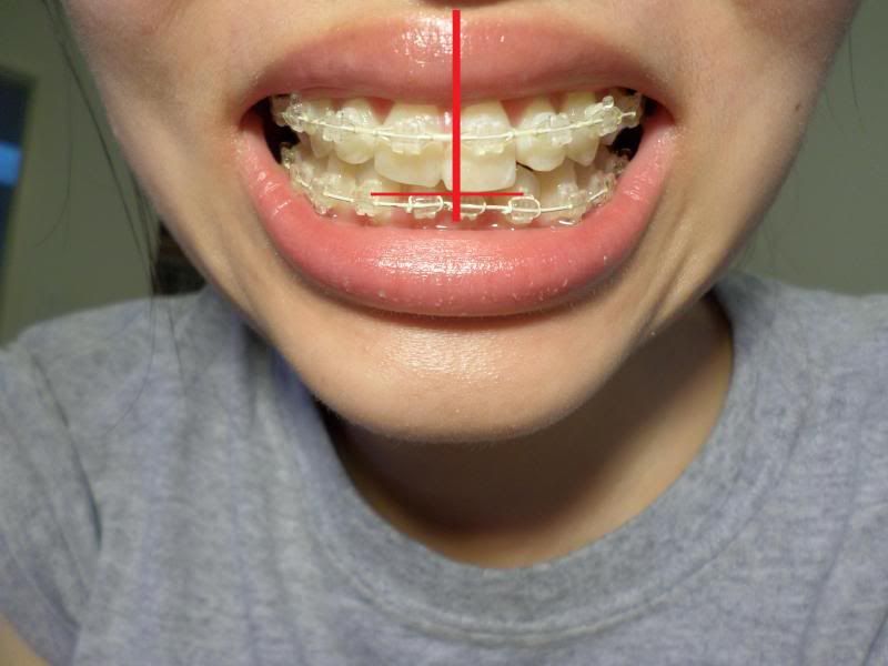 photo middleline.jpg